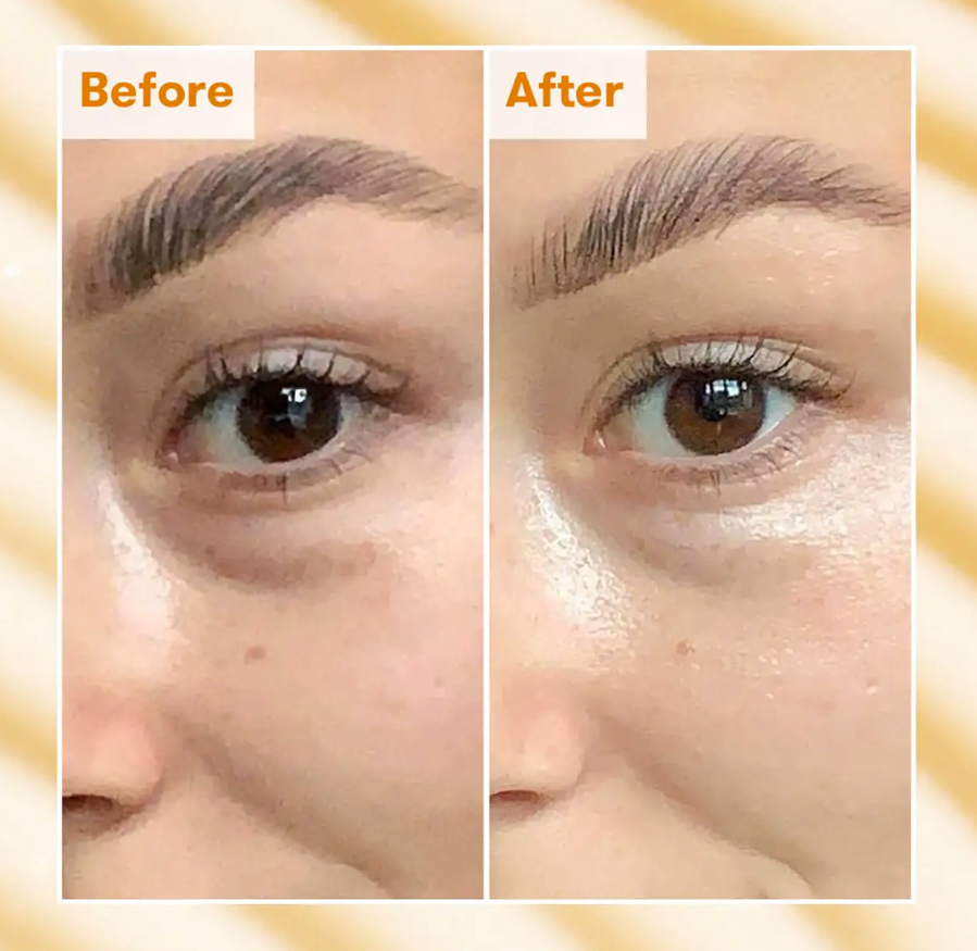 Ren Brightening Dark Circle Eye Cream